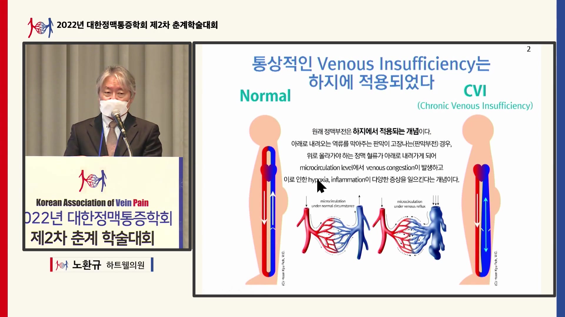 11. 노환규
