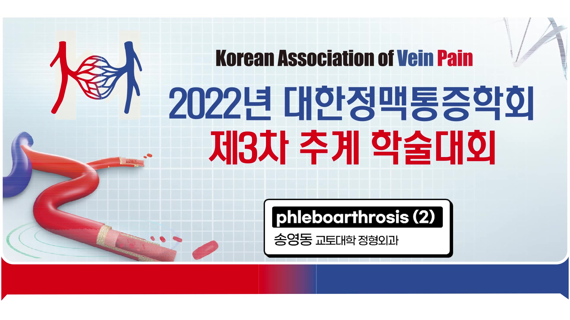 2. 송영동