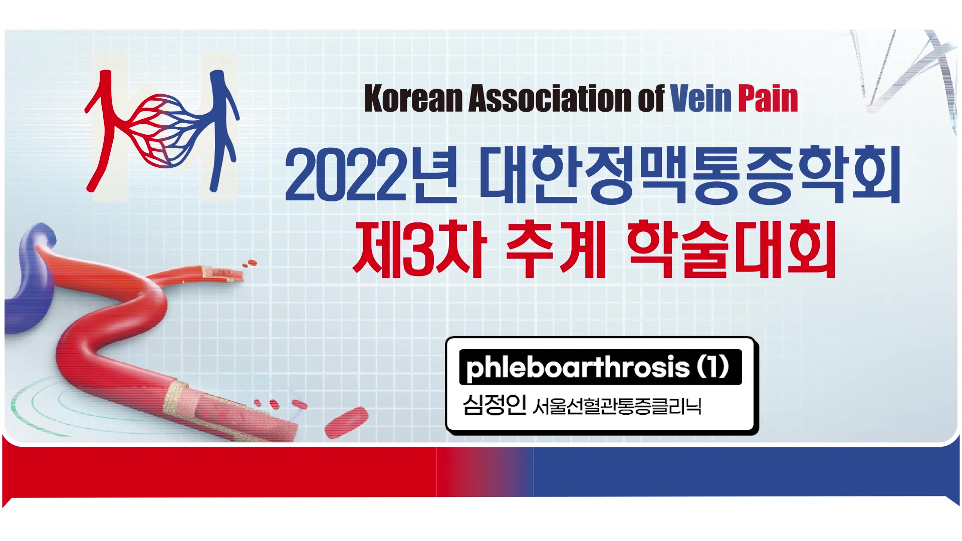 1. 심정인